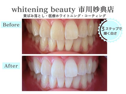 ホワイトニングビューティー 市川妙典店の写真