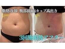 クリーンビューティーメディカルサロン(CLEAN BEAUTY Medical Salon)