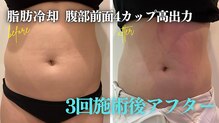クリーンビューティーメディカルサロン(CLEAN BEAUTY Medical Salon)