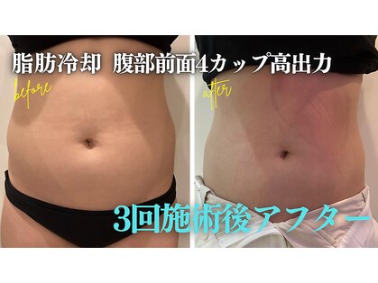 クリーンビューティーメディカルサロン(CLEAN BEAUTY Medical Salon)の写真