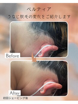 ビューティサロン ベルティア(Beltia)/#脱毛#ダイエット#ブライダル