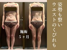 ザ モアナテラス(THE MOANA TERRACE)/痩せながら姿勢も綺麗に