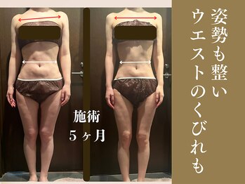 ザ モアナテラス(THE MOANA TERRACE)/痩せながら姿勢も綺麗に