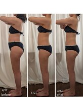 リサプリ(Re: Supple)/インディバ筋膜リンパ