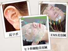 グローウィング整骨院 鍼灸院(Growing整骨院 鍼灸院)の雰囲気（美容鍼・耳ツボ・小顔矯正など美容メニューも豊富◎）