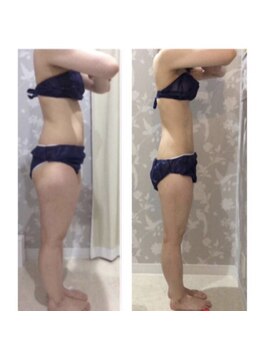 カラット(CARAT)/お客様のビフォーアフター一例