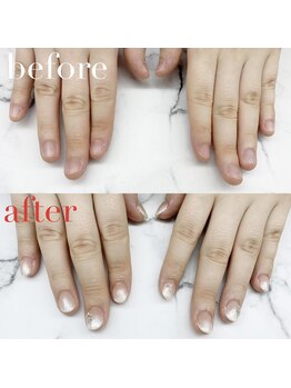 アイネイルズ 布施店(I.NAILS)/深爪/深爪矯正/自爪風ネイル