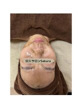 サクラ(Sakura)/剥離なしハーバルメソッド