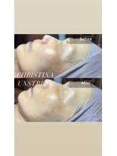 マリー(Mary.)/クリスティーナ・アンストレス