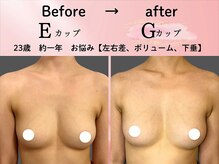 ロットプラス(Lot Plus)の雰囲気（デコルテからしっかりバストアップ。下着を外した時も美乳へ）