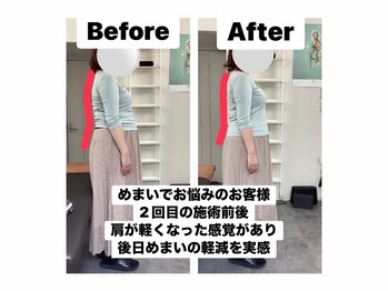 アンティオール 札幌店/40代女性　自律神経/めまい