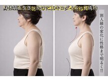 サロンチオリ 烏丸(Salon Chiori)/矯正きっかけで10キロダイエット