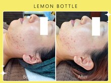 シロカネ イオンタウン西熊本店(SHIROKANE)/レモンボトル☆