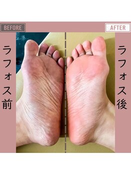 マーリエ(Malie)/【ラフォス】血行不良対策