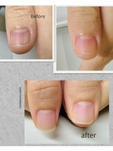 ケアビューティサロン(care beauty salon)/深爪美爪育成ジェル