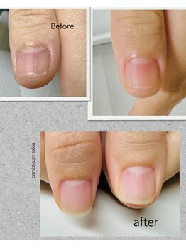 ケアビューティサロン(care beauty salon)/深爪美爪育成ジェル