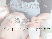 グレイティア(gratia)/バクテリウムピール施術中