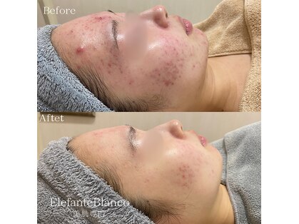 エレファンテブランコ(Elefante Blanco)の写真