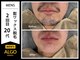 アルゴ 南茨木駅前店(ALGO)の写真/朝の髭剃り時間ゼロ！清潔感と自信を叶える、南茨木のメンズ脱毛体験へご招待★