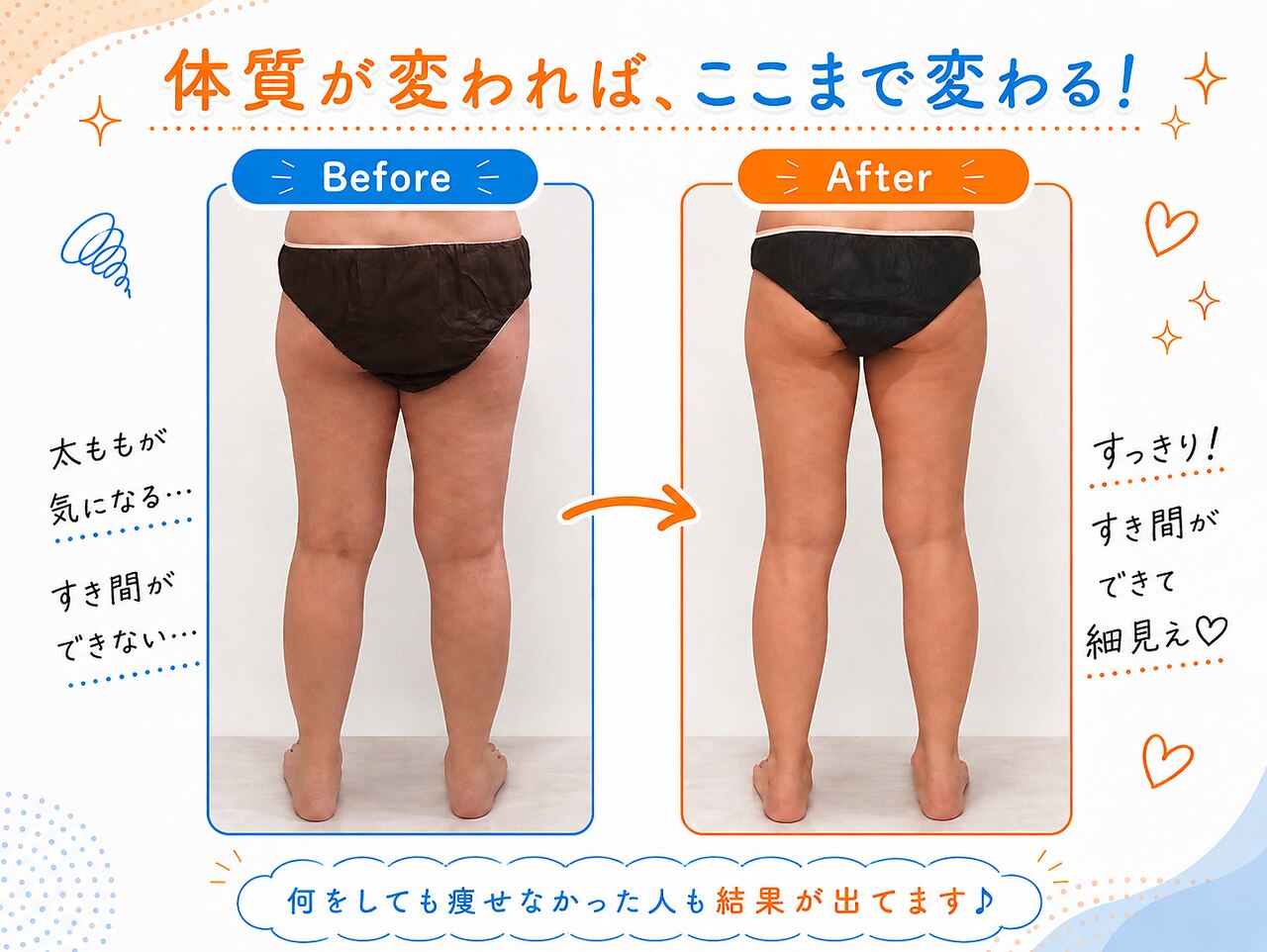 ヨサパーク セン 下北沢(YOSA PARK CEN)｜ホットペッパービューティー