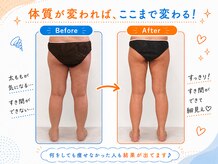 ヨサパーク セン 下北沢(YOSA PARK CEN)