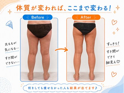 ヨサパーク セン 下北沢(YOSA PARK CEN)の写真