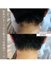 メンズラボ 京都駅前店/清潔感が出るうなじ脱毛人気です