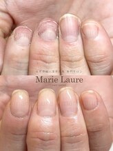 マリーロール 梅田店(Marie Laure)/深爪矯正/自爪育成/自爪風