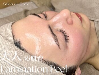 サロンドエクラル(Salon de Eclale wax)/大人の肌育ピーリング