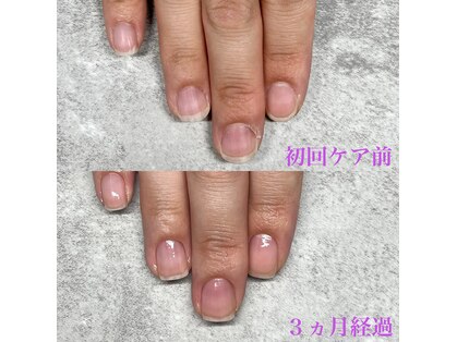 ネイルエリザベス(Nail Elizabeth)の写真