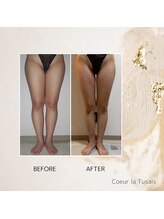 クーラ テュセ(Coeur la Tusais)/下半身集中コース