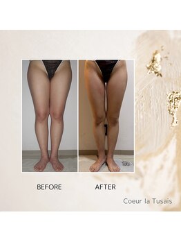 クーラ テュセ(Coeur la Tusais)/下半身集中コース