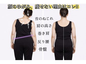 サロンチオリ 烏丸(Salon Chiori)/首の傾きは必ず顔の歪みが出ます