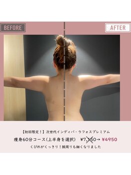 マーリエ(Malie)/【ラフォス】背中～二の腕