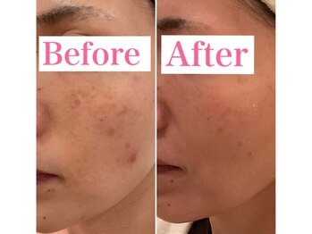 トータルビューティーサロン 凛/女優肌を目指す