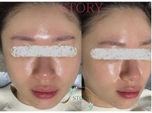 ストーリー(STORY)/眉毛と艶肌ワックス専門店