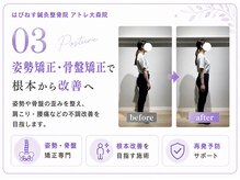 はぴねす鍼灸整骨院 アトレ大森院の雰囲気（姿勢矯正・骨盤矯正で圧倒的な変化を体感して頂けます。）