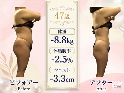 セラピアの写真