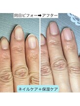 桃の木 吉祥寺店/手の保湿でやる気が上がる