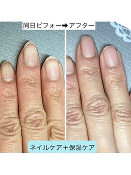 手の保湿でやる気が上がる