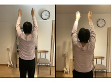 エン 代々木八幡(yen)/手術後遺症で【施術前後の検査】