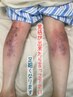 【人気】まるで別人の脚！軽ふわ体験