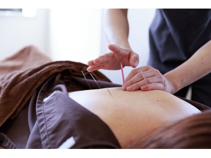 カーム(Calm)の写真