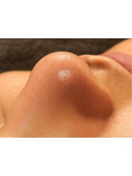 毛穴ケアをしたい