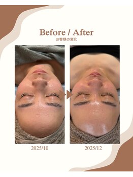 パール エビス(Pearl Ebisu)/ララピール