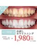 【4日間】24～27日限定◇本格ホワイトニング☆お試し1セット￥1980(通常¥9900