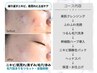 【医師監修/毛穴ニキビ改善】毛穴洗浄+ハーブピーリング◇90分 ¥16,500→