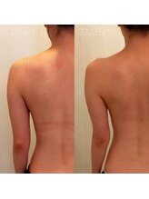 ミールーム(mi room)/痩身エステ