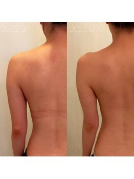 ミールーム(mi room)/痩身エステ