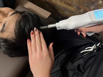サロンゼロ 池上店(Salon ZERO)の写真/《育毛促進！エクソソーム×頭髪改善》プラズマ照射で浸透率UP！新世代エアショットアトマイザー使用♪